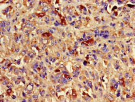 Polyclonal Rabbit anti-Human AURKC / Aurora C Antibody (IHC, IF, WB)