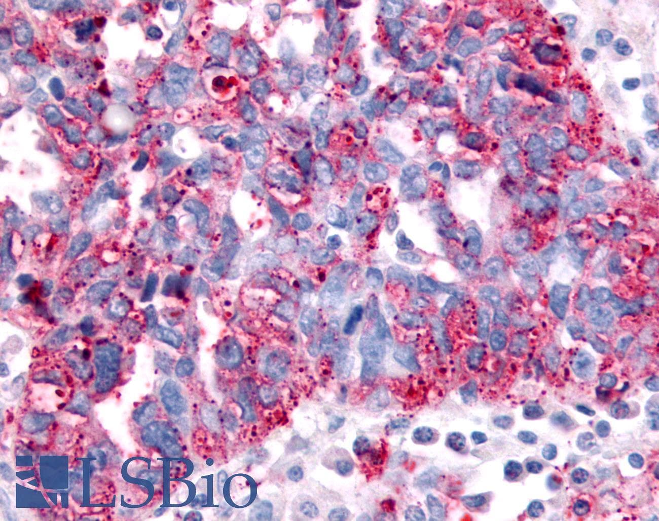 PathPlus™ SGK2 Antibody (Kinase Domain)