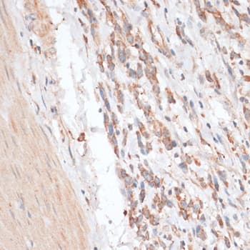 ABCB7 Antibody