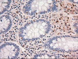 MYC / c-Myc Antibody (clone OTI5G3)