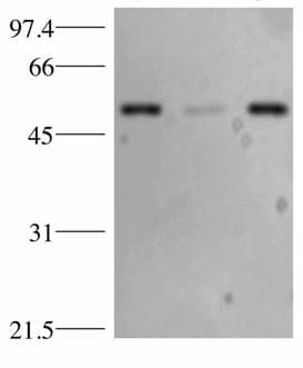 IHC-plus™ TP53 / p53 Antibody (clone BP53-12)