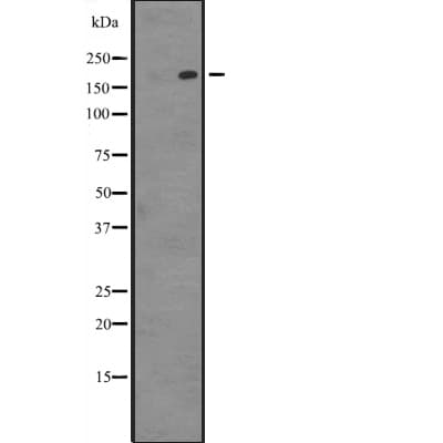 PARP4 / VPARP Antibody