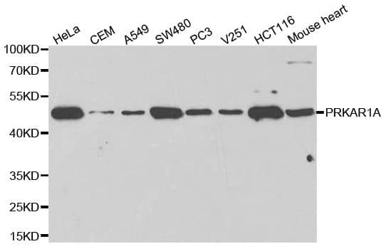 IHC-plus™ Polyclonal Rabbit anti-Human PRKAR1A Antibody (IHC, IF, WB)