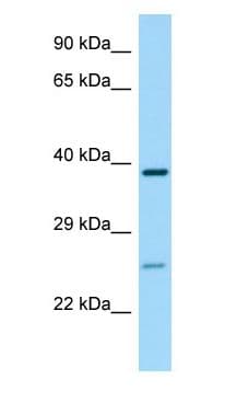 P2RY14 / GPR105 Antibody (aa256-305)