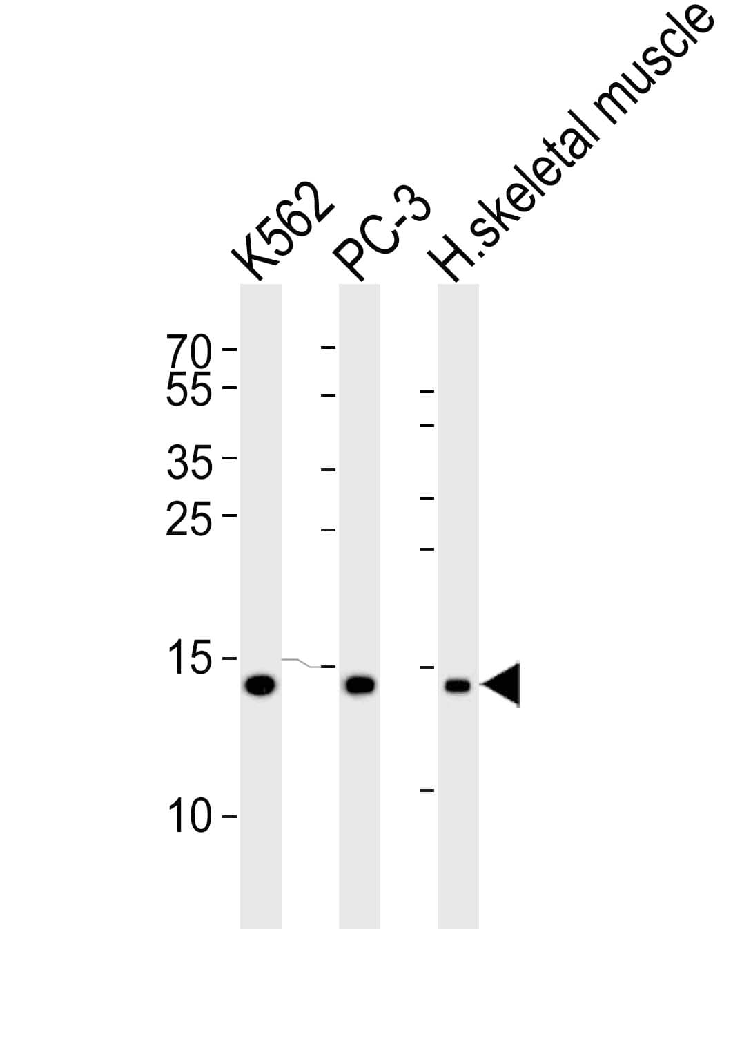 HIST1H2BM Antibody (aa10-44)