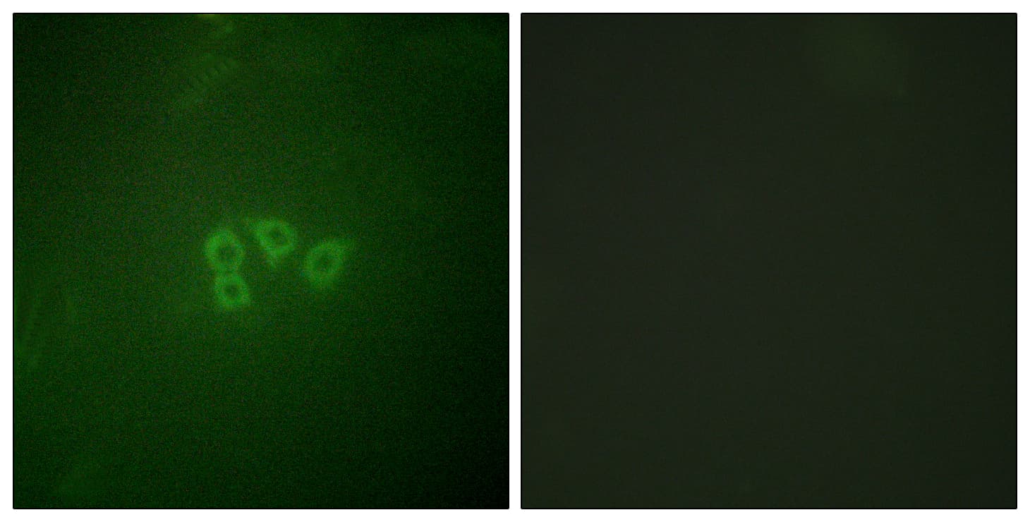 Polyclonal Rabbit anti-Human EIF4B Antibody (aa388-437, IHC, IF, WB)