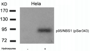 Polyclonal Rabbit anti-Human NBN / Nibrin Antibody (WB)