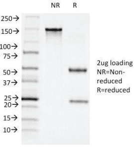 ITGAX / CD11c Antibody (aa600-850, clone ITGAX/1243)
