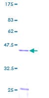 Human UBE2N / UBC13 Protein (Recombinant GST)