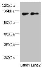 TTC30B Antibody