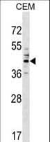 CD66c / CEACAM6 Antibody (aa188-214)