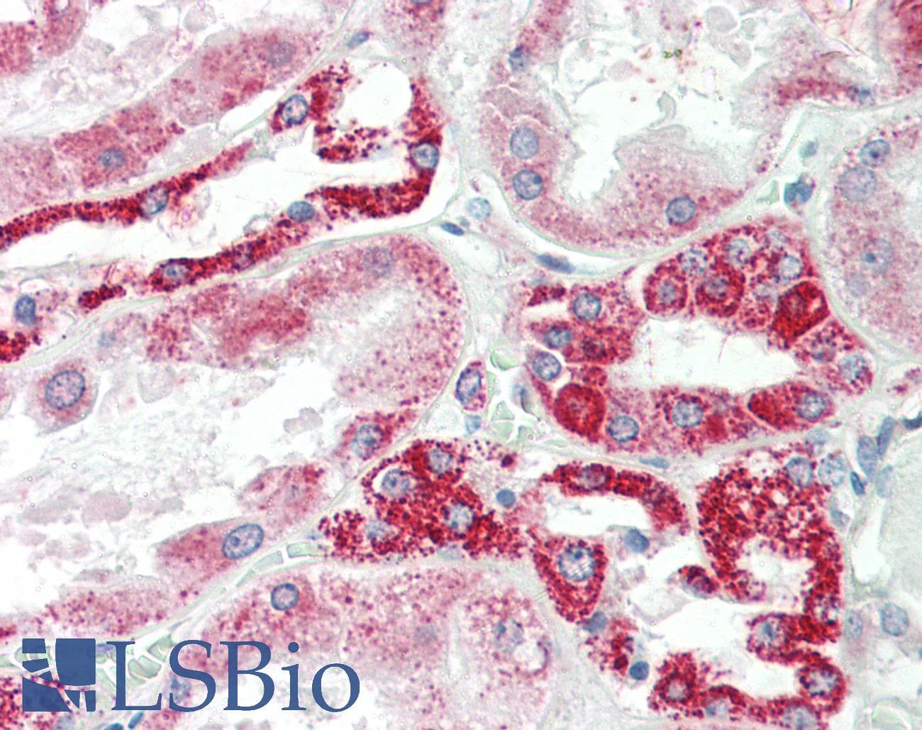 IHC-plus™ NDUFS6 Antibody (aa53-66)