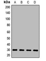 Polyclonal Rabbit anti-Human PQBP1 Antibody (WB)