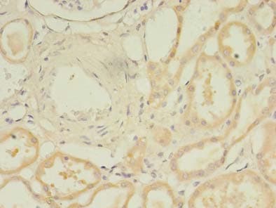 Polyclonal Rabbit anti-Human TARS2 / TARSL1 Antibody (IHC)