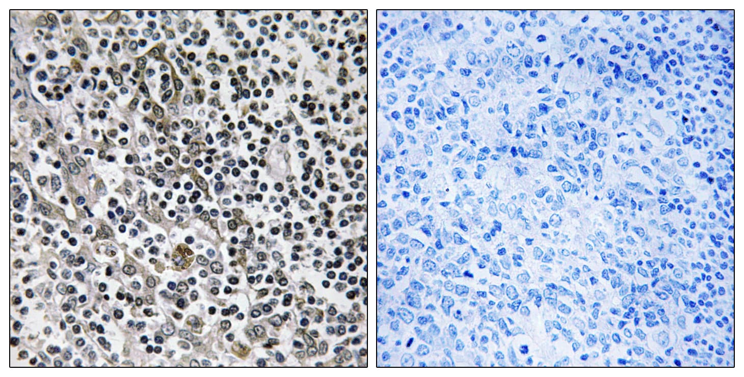 Polyclonal Rabbit anti-Human MRPL51 Antibody (aa51-100, IHC, WB)