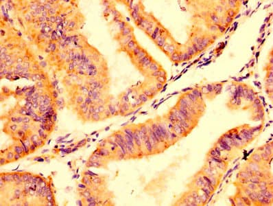 Polyclonal Rabbit anti-Human ABCC8 / SUR1 Antibody (IHC, IF)