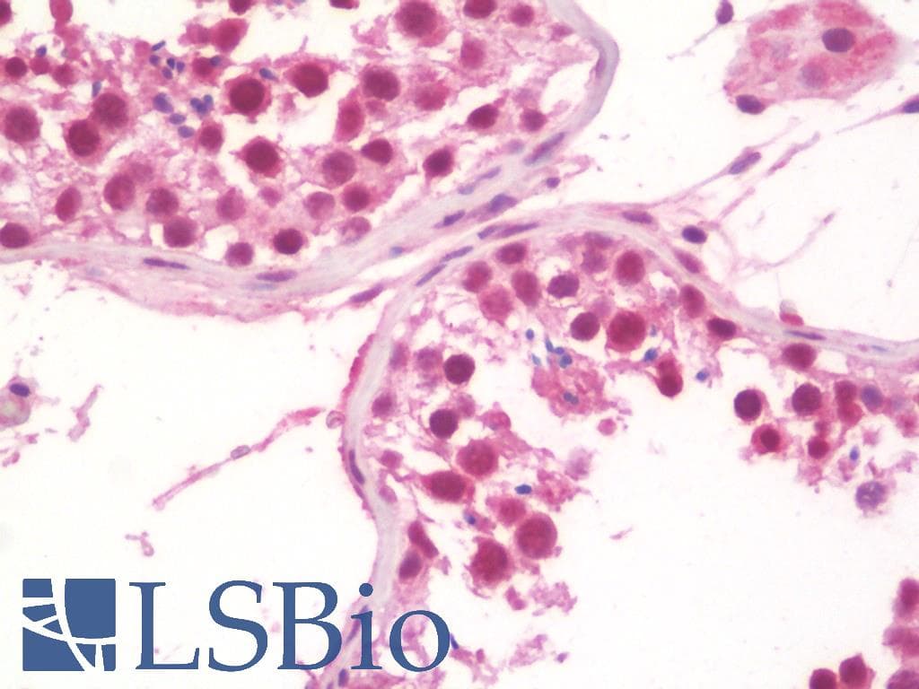 IHC-plus™ TRIM24 / TIF1 Antibody