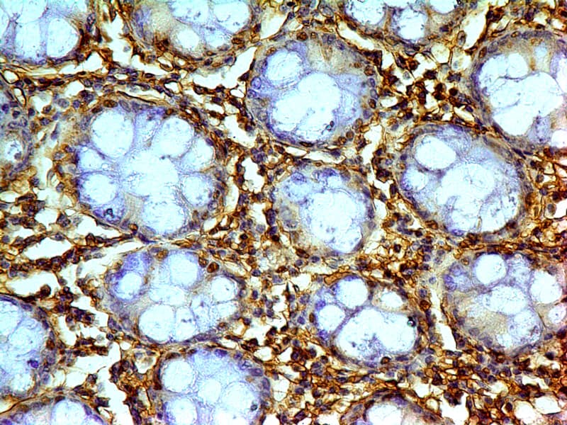 LGALS1 / Galectin 1 Antibody