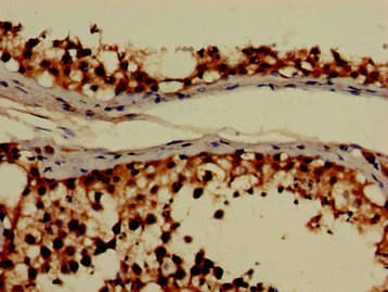 GRHPR / Glyoxylate Reductase Antibody