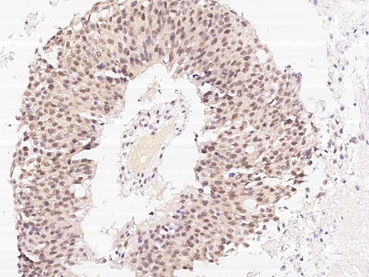 DAPK3 / ZIP Kinase Antibody (Preservative Free)