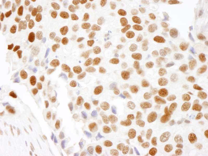 Polyclonal Rabbit anti-Human HMGN1 / HMG14 Antibody (aa90-100, IHC, IF)