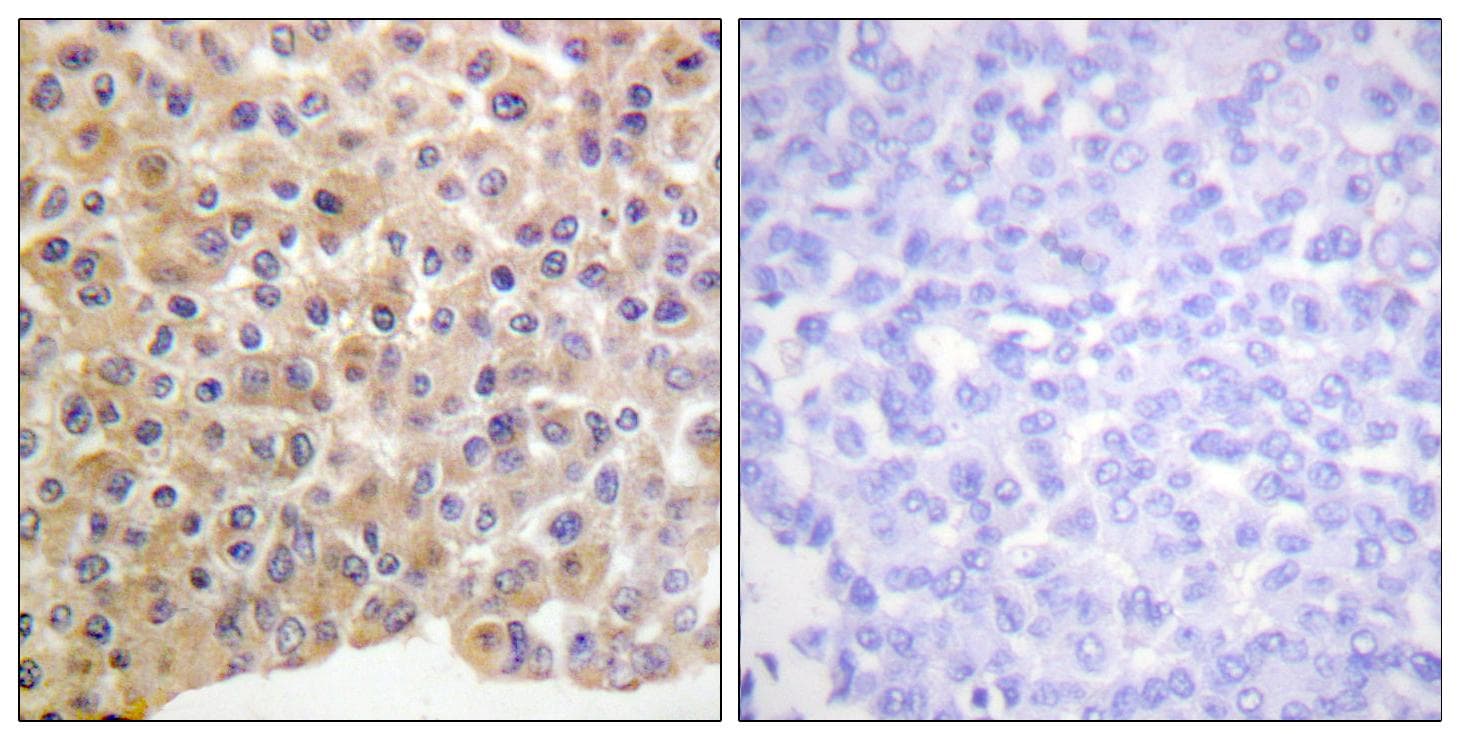 INSR / Insulin Receptor Antibody (phospho-Tyr1361)