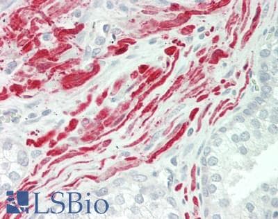 IHC-plus™ MYLK Antibody