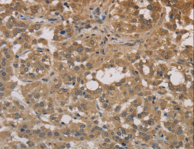 DEGS1 Antibody