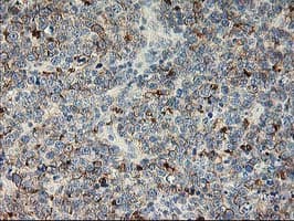 LIMK1 / LIMK Antibody (clone OTI3G3)