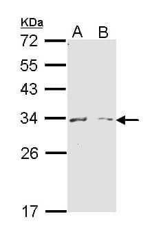 IHC-plus™ Polyclonal Rabbit anti-Human ARG1 / Arginase 1 Antibody (IHC, WB)