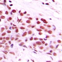 Polyclonal Rabbit anti-Human MYC / c-Myc Antibody (phospho-Thr58, IHC, WB)