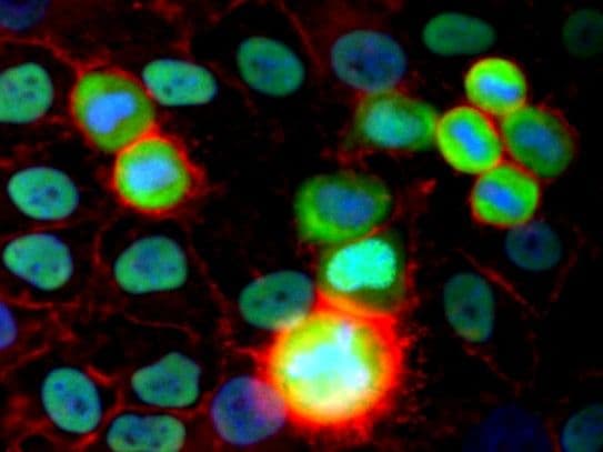 XRCC5 / Ku80 Antibody (clone MEM-54)