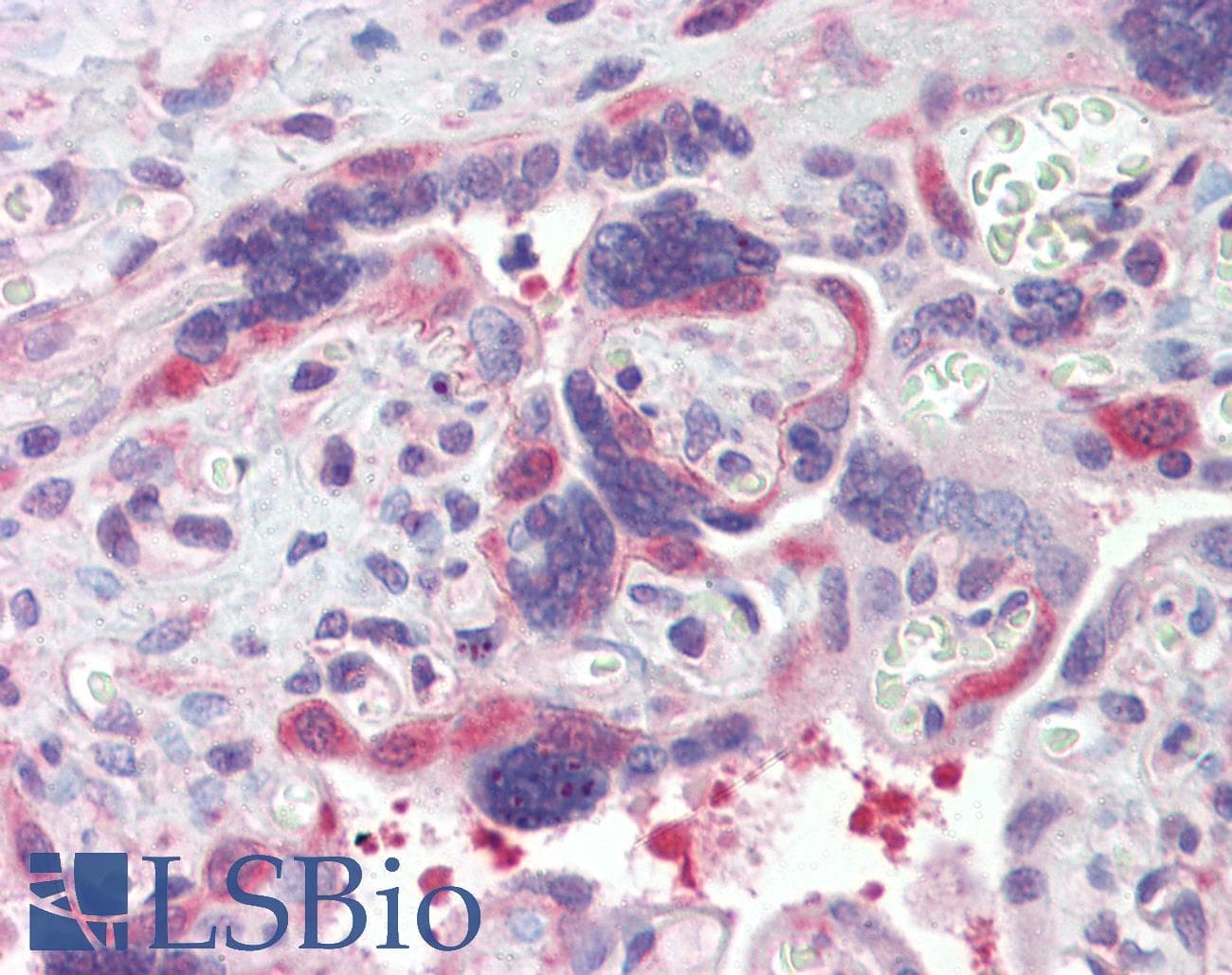 IHC-plus™ Polyclonal Rabbit anti-Human HSP90 / Heat Shock Protein 90 Antibody (aa250-325, IHC, WB)