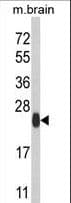 Polyclonal Rabbit anti-Human APG12 / ATG12 Antibody (aa8-38, IF, WB)