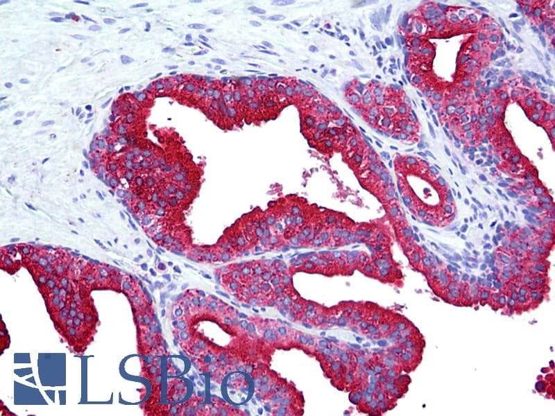 IHC-plus™ LAMP2 / CD107b Antibody