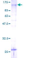 Human PSMD2 Protein (Recombinant GST)