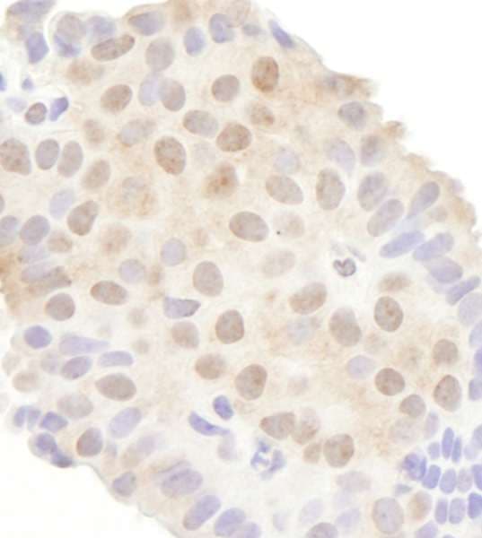 DDX20 / GEMIN3 Antibody (aa600-650)
