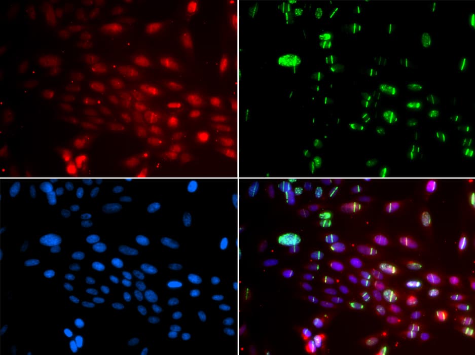 L3MBTL1 Antibody
