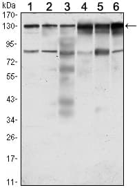 IHC-plus™ CCK4 / PTK7 Antibody (aa31-199, clone 4F9)