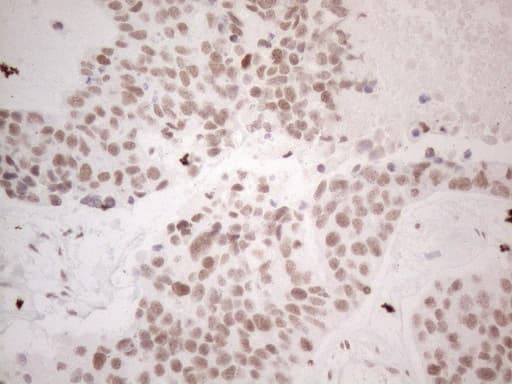 NR2C2 / TAK1 Antibody (aa1-241, clone OTI2H2)