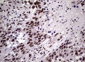 NBN / Nibrin Antibody (clone OTI6H7)