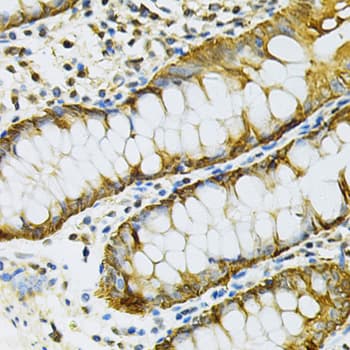 HSP90AB1 / HSP90 Alpha B1 Antibody