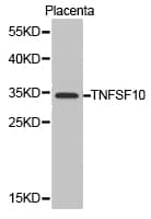 TNFSF10 / TRAIL Antibody