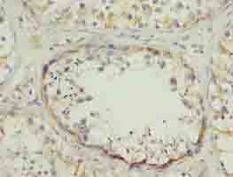 Polyclonal Rabbit anti-Human SPZ1 Antibody (IHC, WB)
