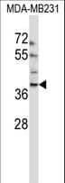 Polyclonal Rabbit anti-Human EMID1 Antibody (aa54-82, WB)