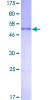 Human NAA10 / ARD1A Protein (Recombinant GST)
