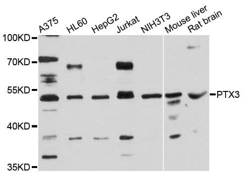 PTX3 / Pentraxin 3 Antibody
