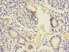 NPPB / BNP Antibody (aa27-102)