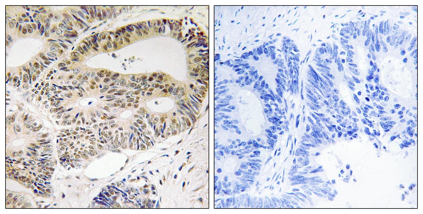 OXSR1 / OSR1 Antibody (Ab-185)