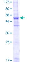Human MS4A2 / FCERI Protein (Recombinant GST)